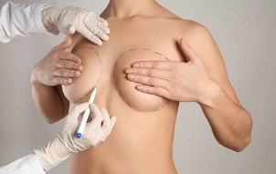 meetodid rindade suurendamiseks operatsiooniga